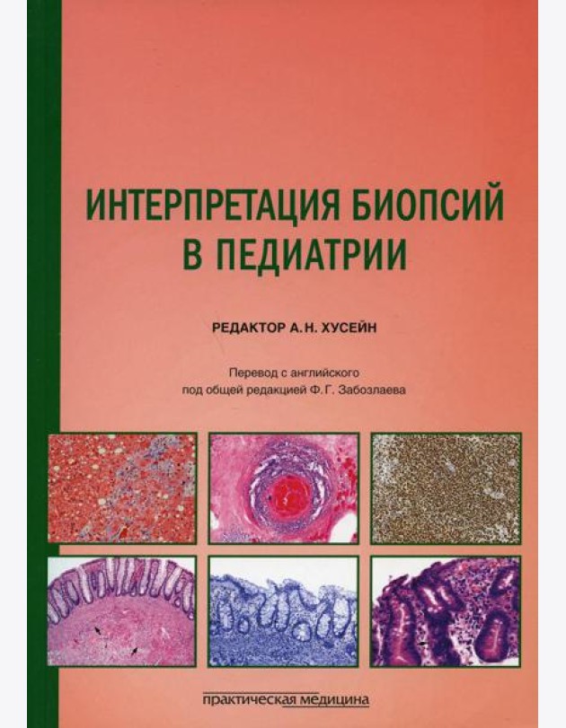 Интерпретация биопсий в педиатрии