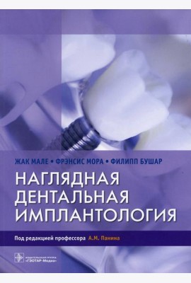 Наглядная дентальная имплантология