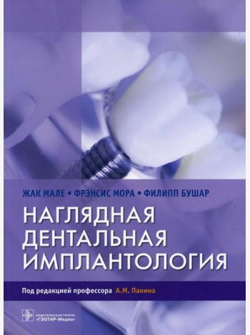 Наглядная дентальная имплантология