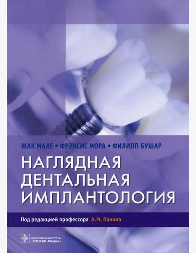 Наглядная дентальная имплантология