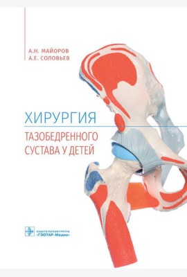 Хирургия тазобедренного сустава у детей