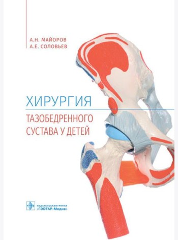 Хирургия тазобедренного сустава у детей