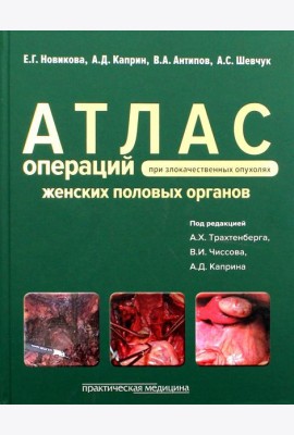 Атлас операций при злокачественных опухолях женских половых органов