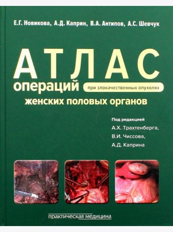 Атлас операций при злокачественных опухолях женских половых органов