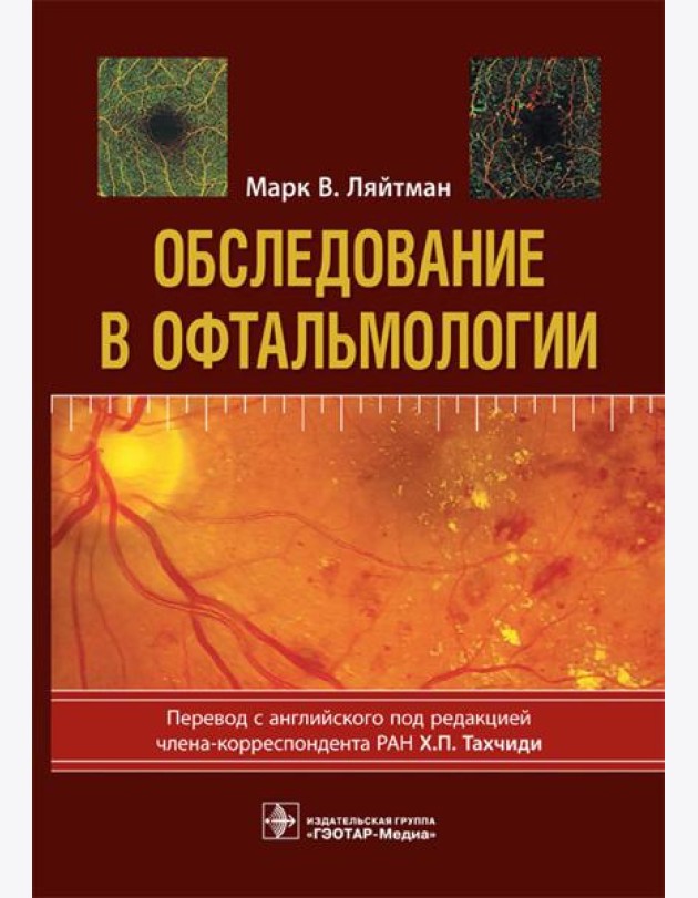 Обследование в офтальмологии