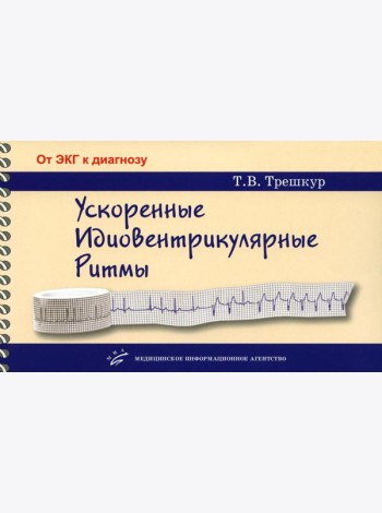 Ускоренные идиовентрикулярные ритмы: клинико-электрокардиографические особенности, систематизация по ЭКГ-характеристикам, дифференцирование с другими