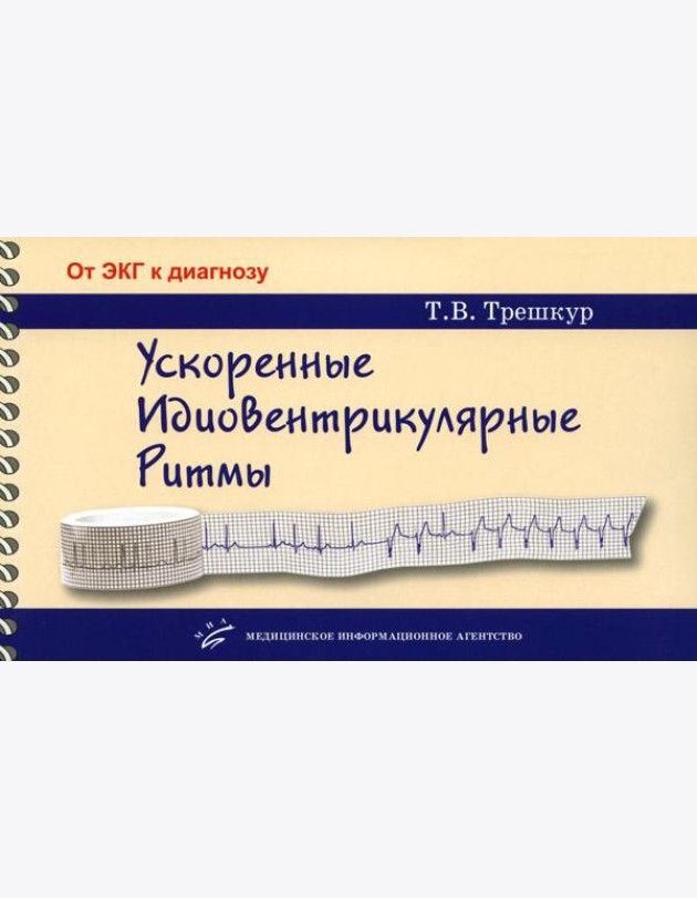 Ускоренные идиовентрикулярные ритмы: клинико-электрокардиографические особенности, систематизация по ЭКГ-характеристикам, дифференцирование с другими