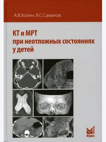 КТ и МРТ при неотложных состояниях у детей