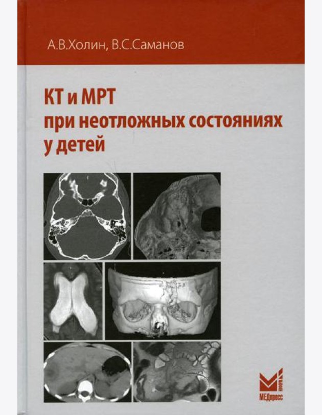 КТ и МРТ при неотложных состояниях у детей