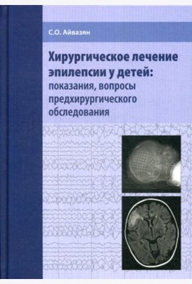 Хирургическое лечение эпилепсии у детей: показания, вопросы предхирургического обследования