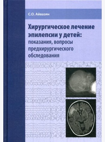 Хирургическое лечение эпилепсии у детей: показания, вопросы предхирургического обследования