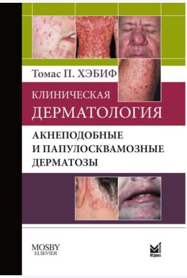 Клиническая дерматология. Акнеподобные и папулосквамозные дерматозы