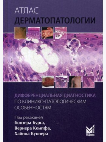 Атлас дерматопатологии: Дифференциальная диагностика по клинико-патологическим особенностям