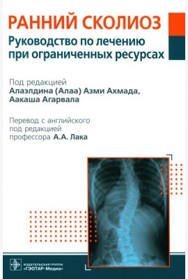 Ранний сколиоз. Руководство по лечению при ограниченных ресурсах