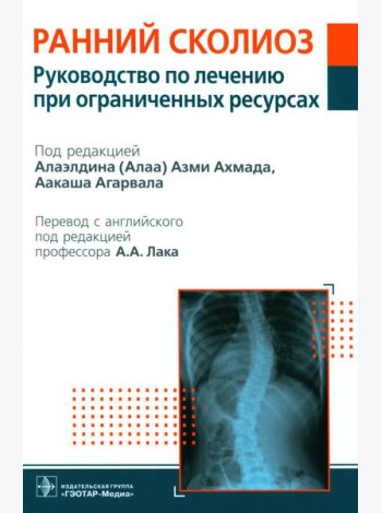 Ранний сколиоз. Руководство по лечению при ограниченных ресурсах