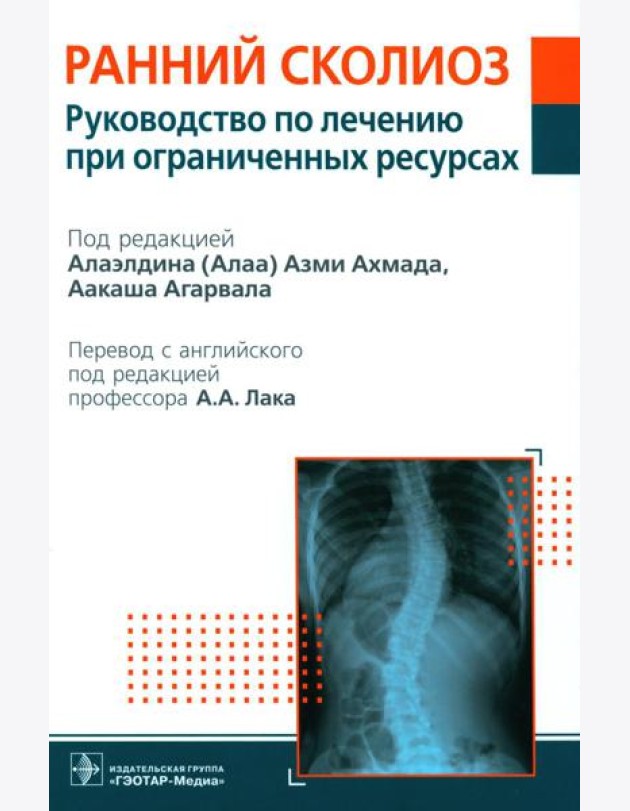 Ранний сколиоз. Руководство по лечению при ограниченных ресурсах