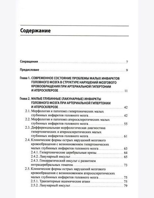 Малые инфаркты головного мозга