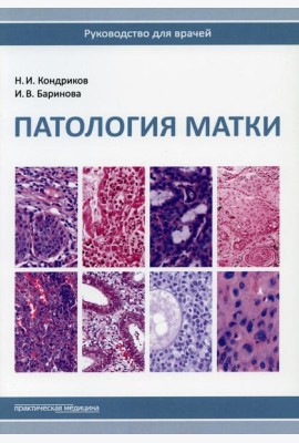 Патология матки. Руководство для врачей. 2-е изд