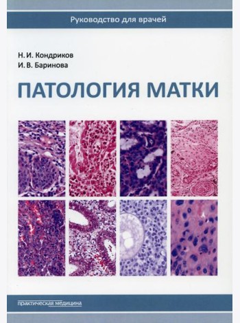 Патология матки. Руководство для врачей. 2-е изд