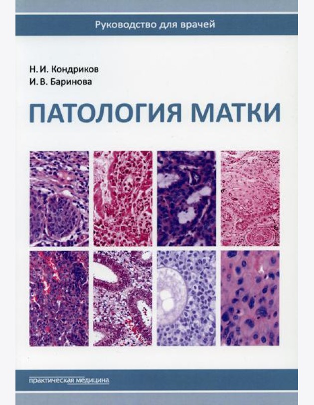 Патология матки. Руководство для врачей. 2-е изд