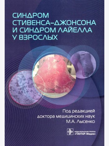 Синдром Стивенса–Джонсона и синдром Лайелла у взрослых