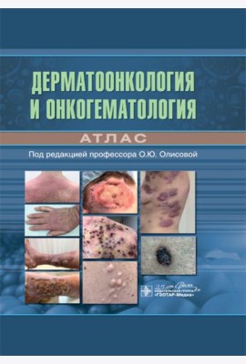 Дерматоонкология и онкогематология. Атлас