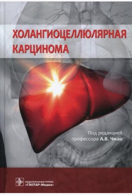 Холангиоцеллюлярная карцинома