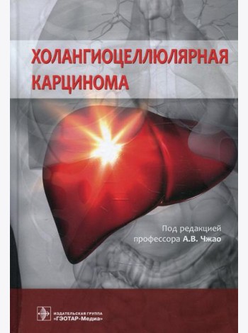 Холангиоцеллюлярная карцинома