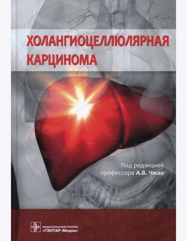 Холангиоцеллюлярная карцинома