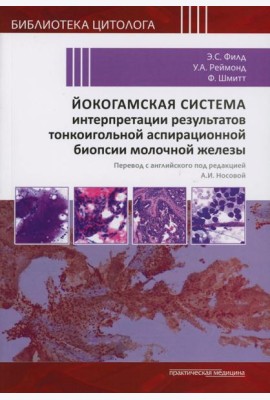 Йокогамская система интерпретации результатов тонкоигольной аспирационной биопсии молочной железы