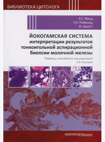 Йокогамская система интерпретации результатов тонкоигольной аспирационной биопсии молочной железы