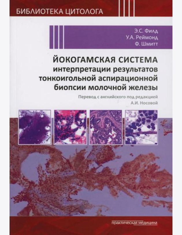 Йокогамская система интерпретации результатов тонкоигольной аспирационной биопсии молочной железы