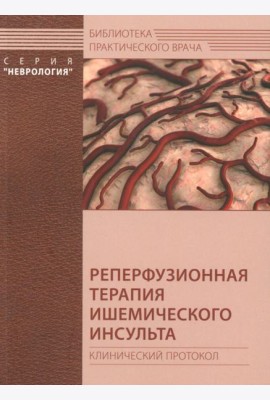 Реперфузионная терапия ишемического инсульта. Клинический протокол