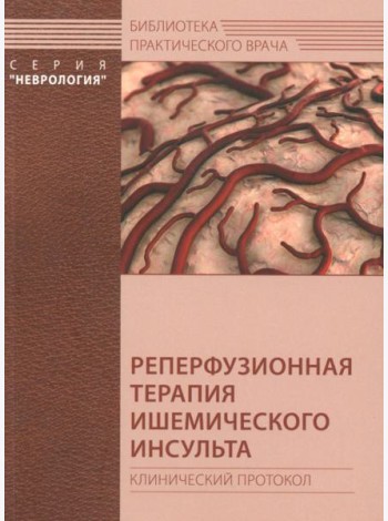 Реперфузионная терапия ишемического инсульта. Клинический протокол