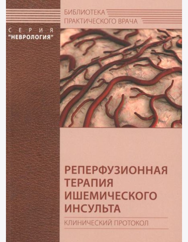 Реперфузионная терапия ишемического инсульта. Клинический протокол