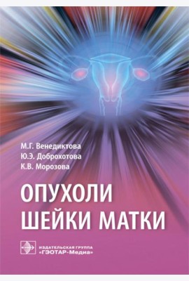 Опухоли шейки матки
