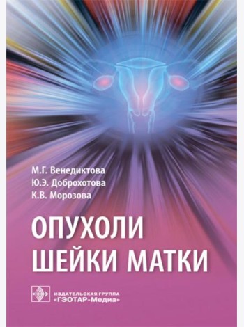 Опухоли шейки матки