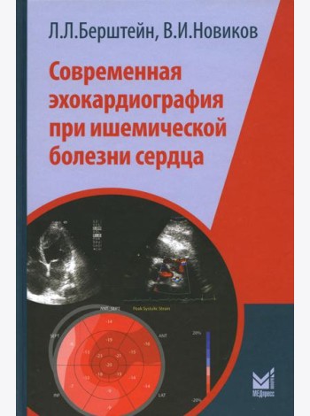 Современная эхокардиография при ишемической болезни сердца