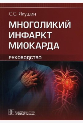Многоликий инфаркт миокарда. Руководство