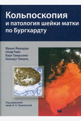 Кольпоскопия и патология шейки матки по Бургхардту