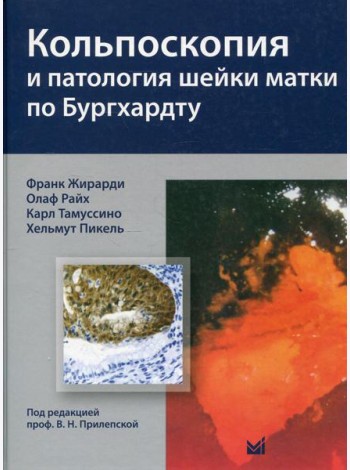 Кольпоскопия и патология шейки матки по Бургхардту