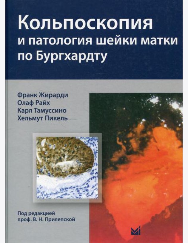 Кольпоскопия и патология шейки матки по Бургхардту