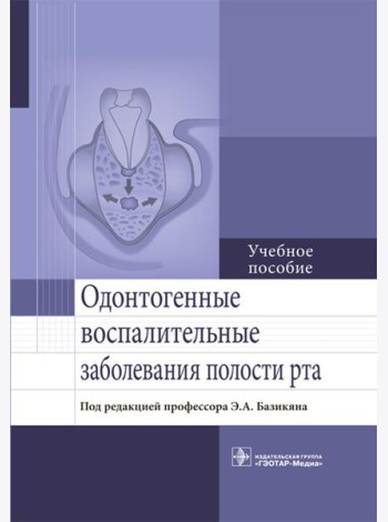 Одонтогенные воспалительные заболевания полости рта. Учебное пособие
