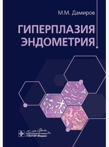Гиперплазия эндометрия