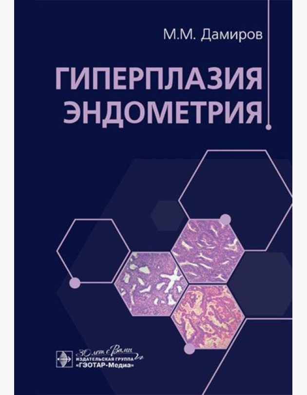 Гиперплазия эндометрия
