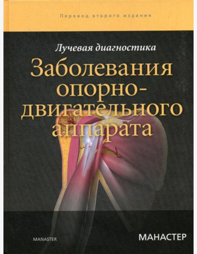 Лучевая диагностика. Заболевания опорно-двигательного аппарата. 2-е изд