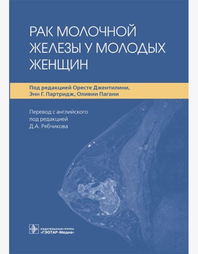 Рак молочной железы у молодых женщин