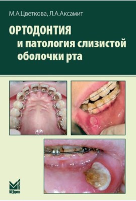 Ортодонтия и патология слизистой оболочки рта