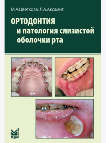 Ортодонтия и патология слизистой оболочки рта