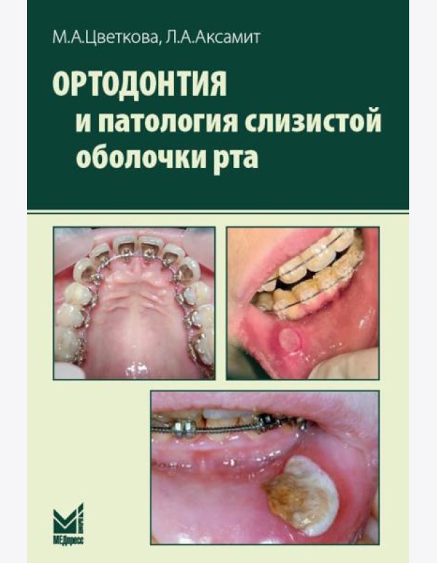 Ортодонтия и патология слизистой оболочки рта
